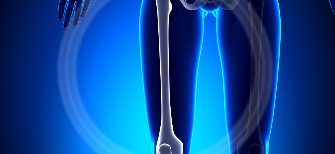 Female Femur - Anatomy Bones